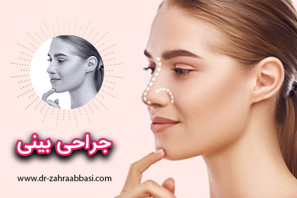 جراحی بینی در تهران - دکتر عباسی