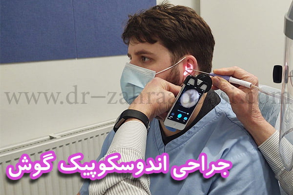 جراحی اندوسکوپیک گوش + دکتر زهرا عباسی