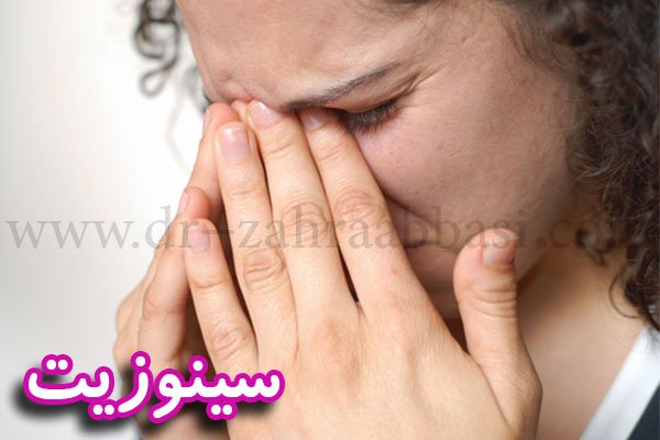 سینوزیت + دکتر زهرا عباسی