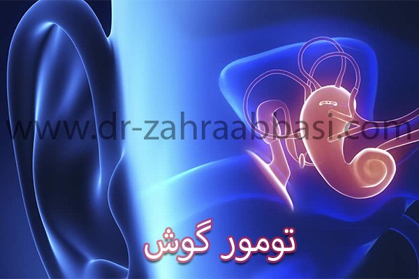 تومور گوش - دکتر زهرا عباسی