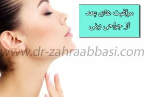 مراقبت های بعد از جراحی بینی - دکتر زهرا عباسی