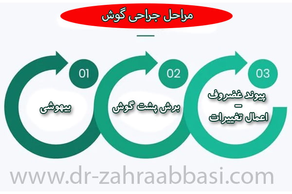 جراحی گوش در تهران - دکتر عباسی