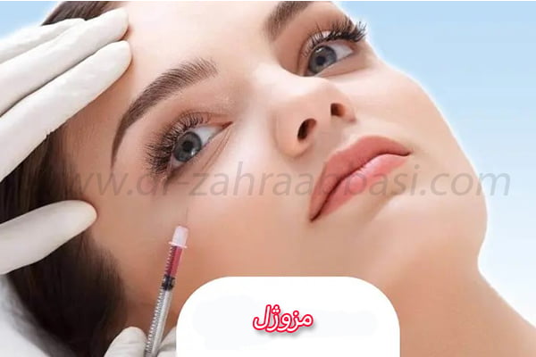 مزوژل - دکتر عباسی