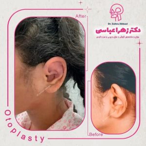 نمونه کار بهترین جراح گوش تهران