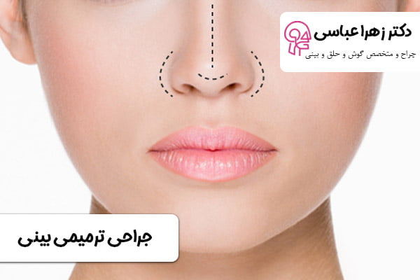جراحی ترمیمی بینی - دکتر زهرا عباسی