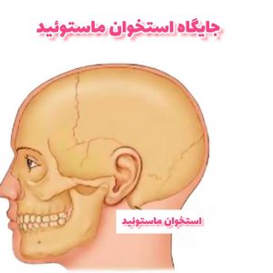 درمان ماستوئیدیت در تهران _ دکتر زهرا عباسی