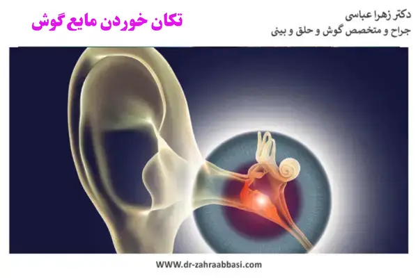 تکان خوردن مایع گوش _ دکتر زهرا عباسی