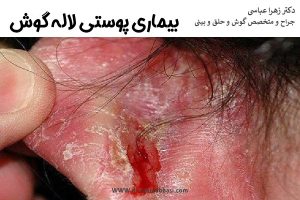 بیماری پوستی لاله گوش + راهکارهای درمانی